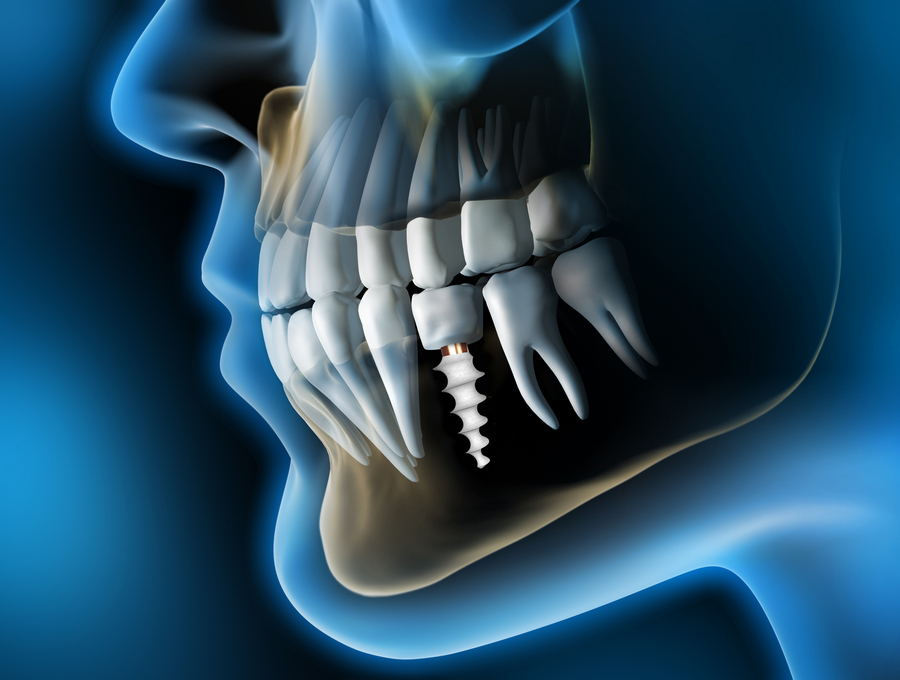 Detailed Smile Design: Utilizing Modern Technologies for Pre-Visualization of Treatment Outcomes
