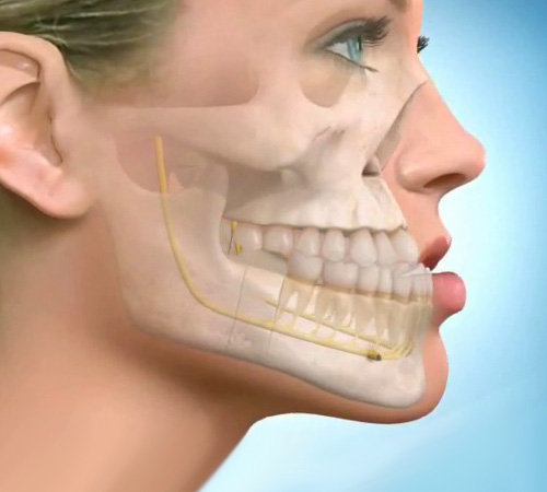 Orthognathic Orthodontics: Combined Treatment for Achieving Optimal Bite and Facial Aesthetics